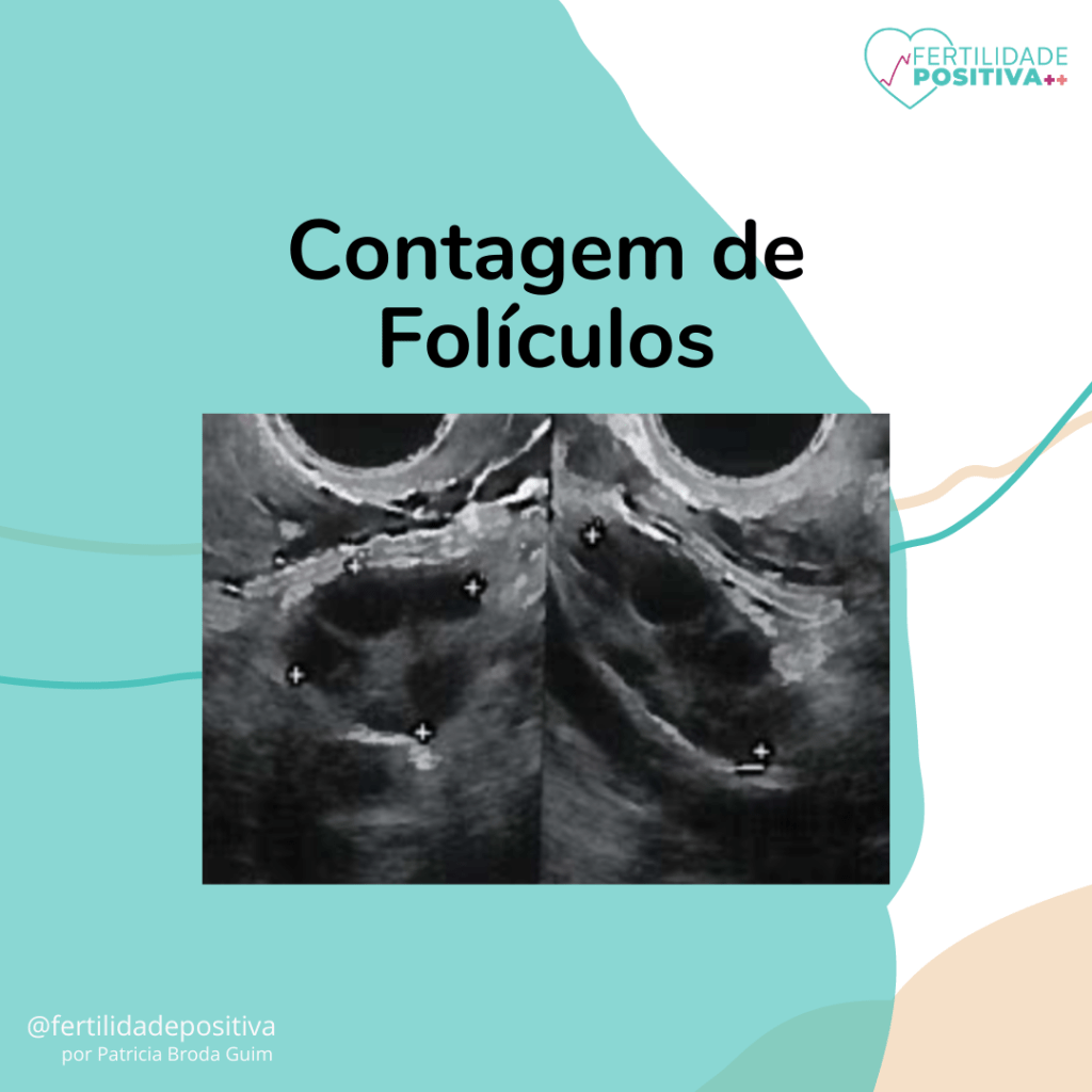 Contagem de folículos