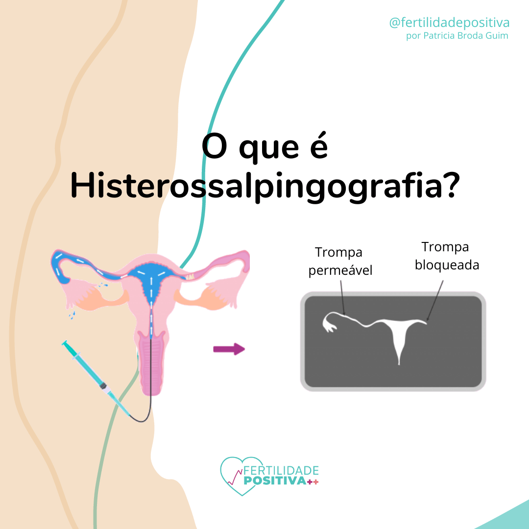 HISTEROSSALPINGOGRAFIA