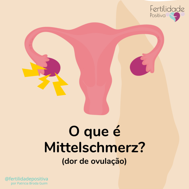 Mittelschemerz (dor do meio ou dor de&nbsp;ovulação)